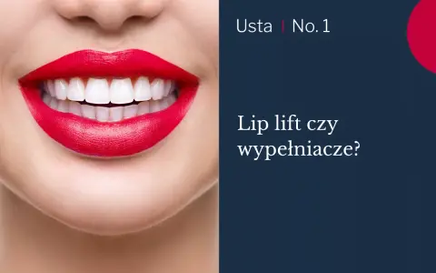 Usta po zabiegu lip lift, z idealnie białymi zębami i czerwonymi ustami.