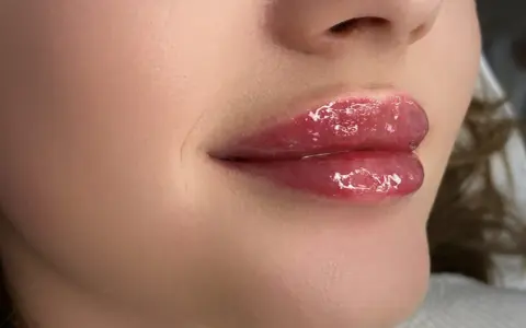 Błyszczące, pełne usta baby doll po zabiegu makijażu permanentnego.
