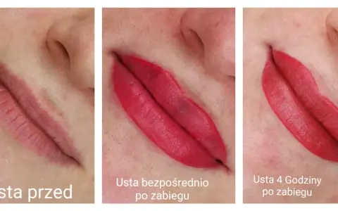 Porównanie ust przed makijażem permanentnym, bezpośrednio po zabiegu i 4 godziny później. Pokazuje, jak długo goją się usta po makijażu permanentnym.